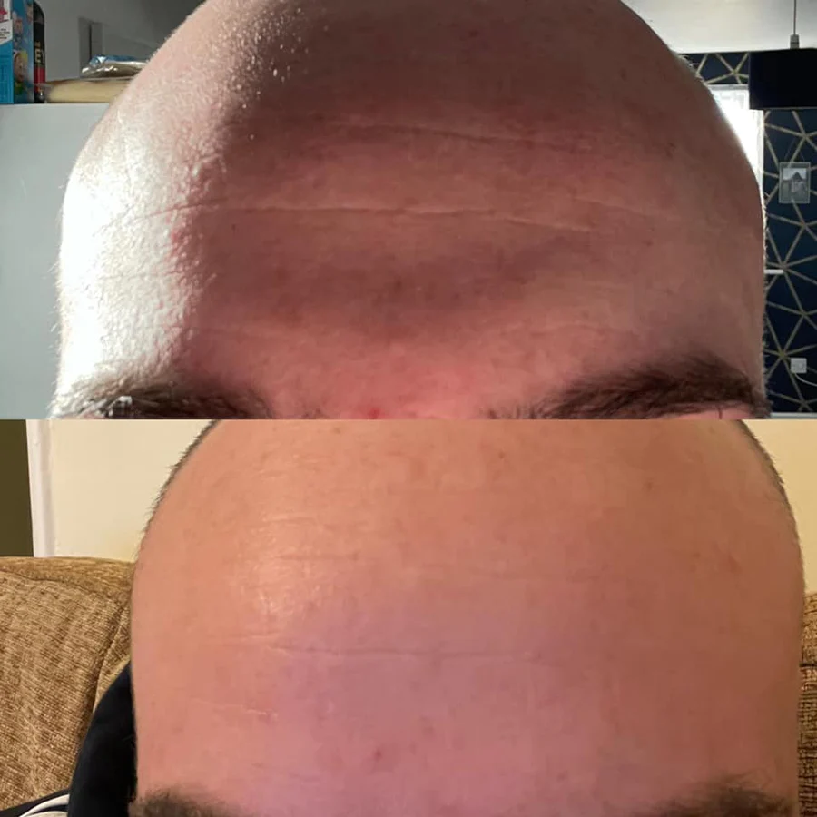 Herbalife Collagen Skin Booster – synlige hudforbedringer