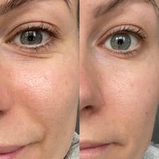 Herbalife Collagen Skin Booster – forbedrer hudens elastisitet